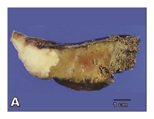 Details are in the caption following the image