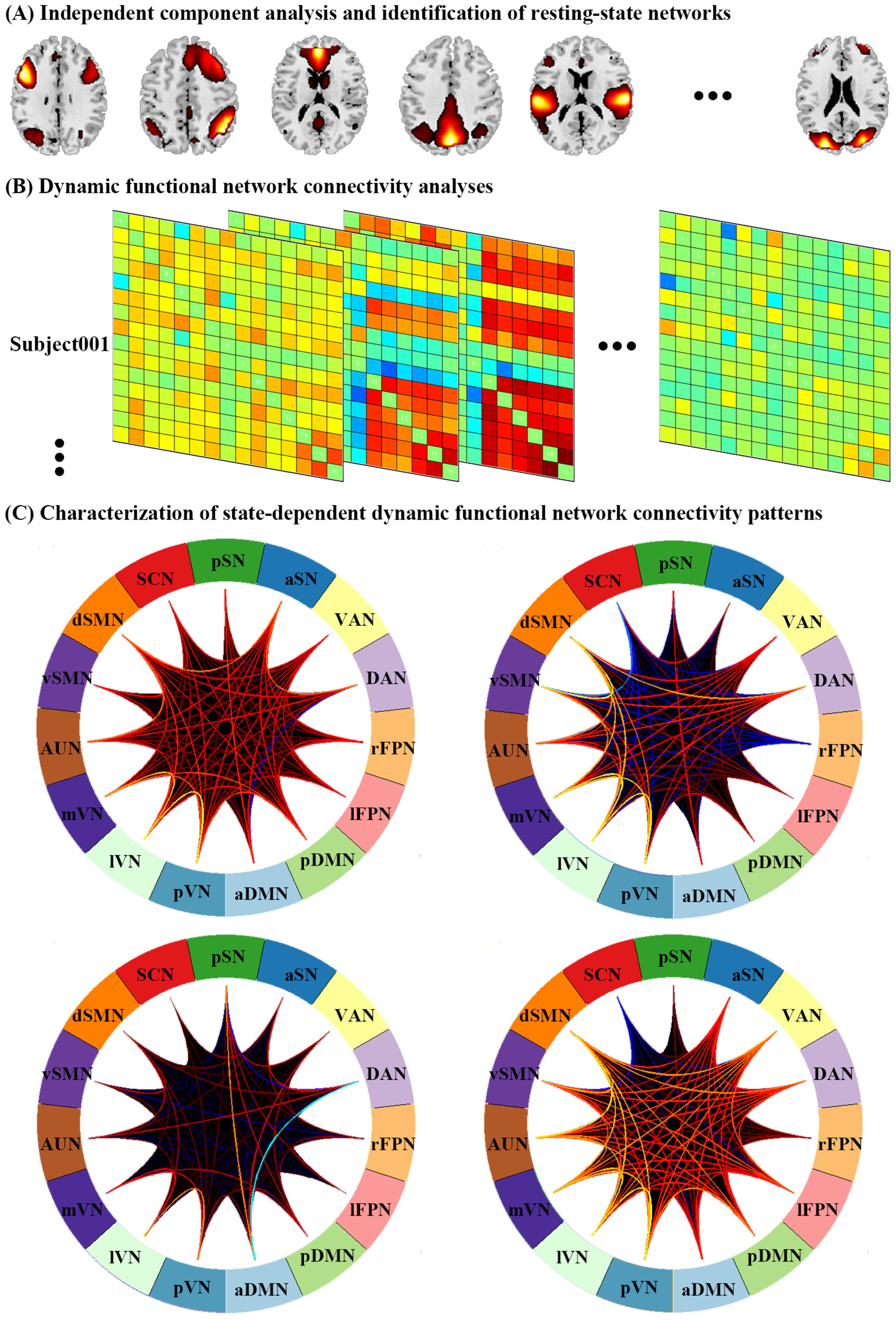 Abnormal large-scale brain functional network dynamics in social anxiety disorder