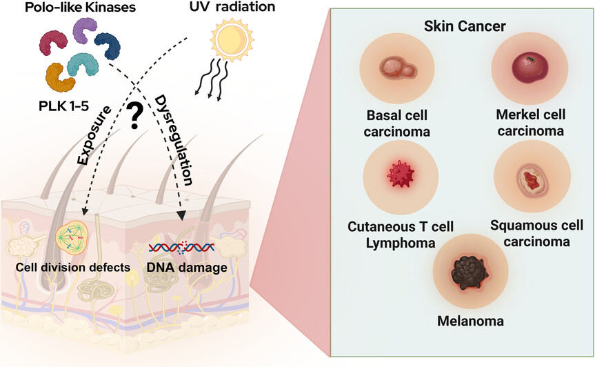 Polo-like kinases and UV-induced skin carcinogenesis: What we know and what's next Issue ,