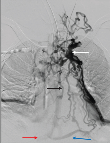 Details are in the caption following the image Details are in the caption following the image