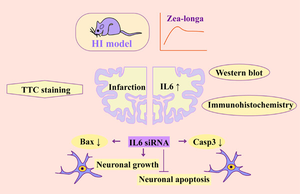Knockdown of interleukin-6 plays a neuroprotective role against hypoxia-ischemia in neonatal rats via inhibition of caspase 3 and Bcl-2-associated X protein signaling pathway