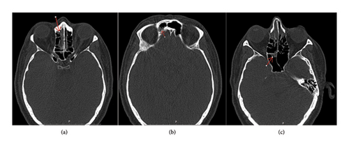 Details are in the caption following the image Details are in the caption following the image