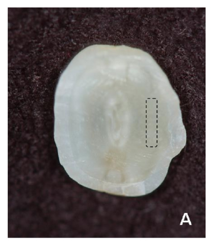 Details are in the caption following the image