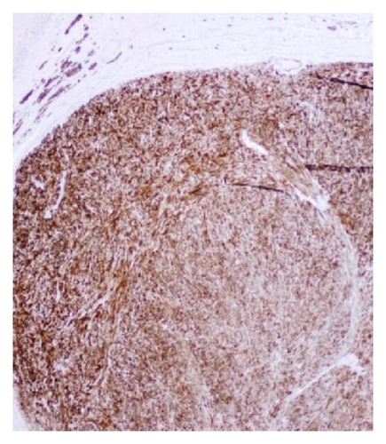 Details are in the caption following the image