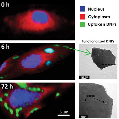 Internalization kinetics and cytoplasmic localization of functionalized diatomite nanoparticles in cancer cells by Raman imaging