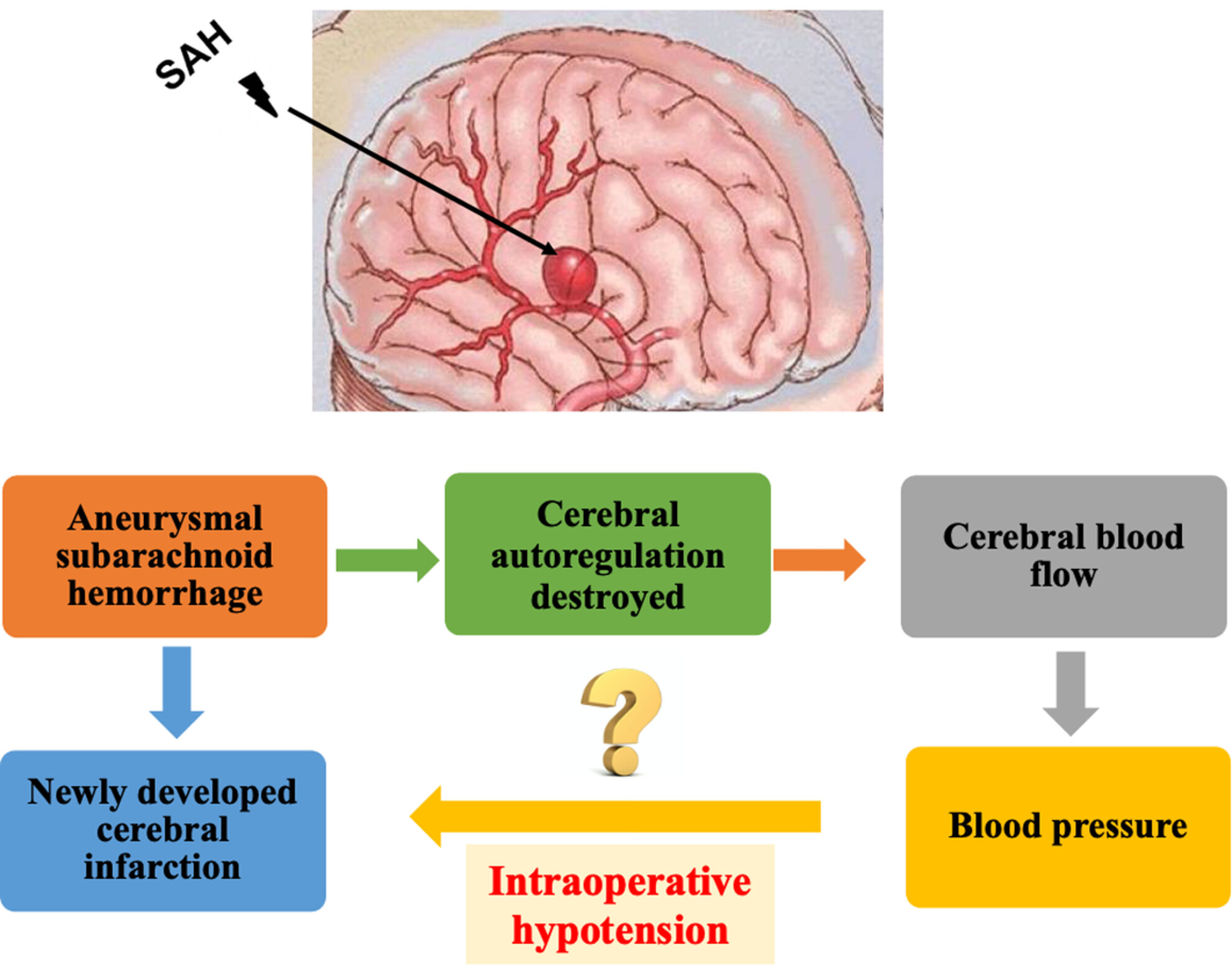 Intraoperative Hypotension and Postoperative Newly Developed Cerebral Infarction in Patients With Aneurysmal Subarachnoid Hemorrhage: A Retrospective Cohort Study