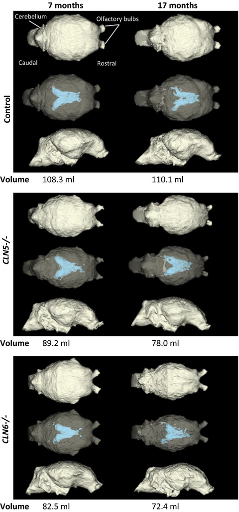 Computed tomography provides enhanced techniques for longitudinal monitoring of progressive intracranial volume loss associated with regional neurodegeneration in ovine neuronal ceroid lipofuscinoses
