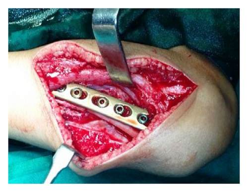 Details are in the caption following the image Details are in the caption following the image