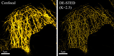 Low-power compact continuous-wave stimulated emission depletion microscopy