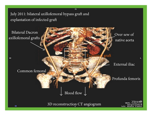 Details are in the caption following the image
