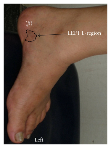 Details are in the caption following the image