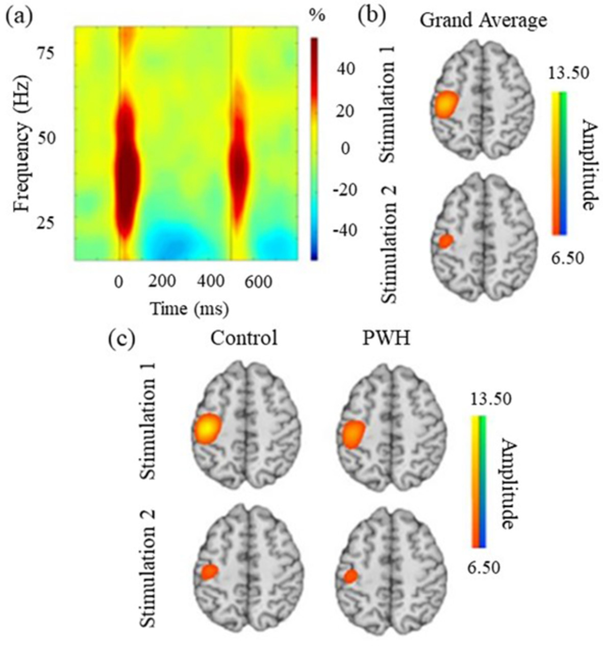 Impact of HIV-infection on human somatosensory processing, spontaneous cortical activity, and cortical thickness: A multimodal neuroimaging approach