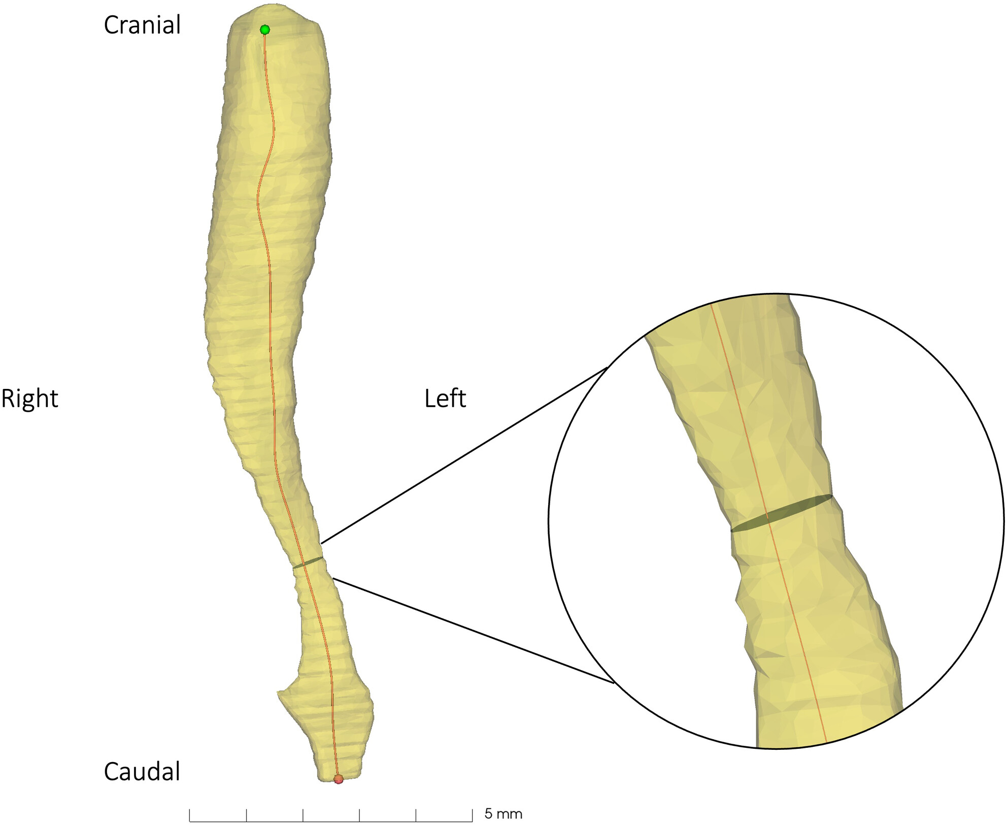 Micro-CT Imaging of Tracheal Development in Down Syndrome and Non-Down Syndrome Fetuses