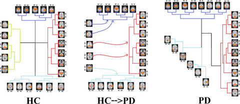 Characterizing resting-state networks in Parkinson’s disease: A multi-aspect functional connectivity study