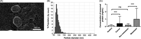 Circulating exosomes contain protein biomarkers of metastatic non-small-cell lung cancer
