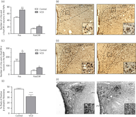 Hormonal and neural responses to restraint stress in an animal model of perimenopause in female rats
