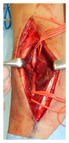 Details are in the caption following the image Details are in the caption following the image