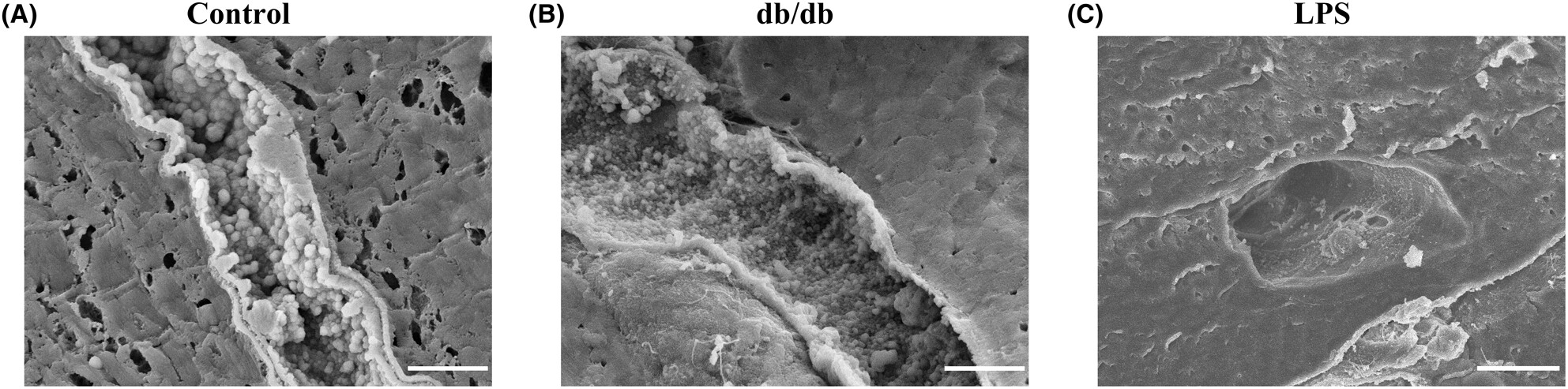 The endothelial glycocalyx—All the same? No, it is not