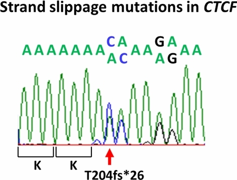 High Frequency Strand Slippage Mutations in CTCF in MSI-Positive Endometrial Cancers
