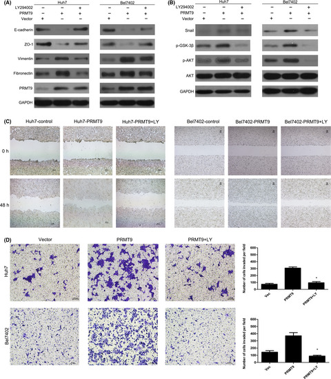 PRMT9 promotes hepatocellular carcinoma invasion and metastasis via activating PI3K/Akt/GSK-3β/Snail signaling