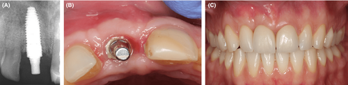Details are in the caption following the image Details are in the caption following the image