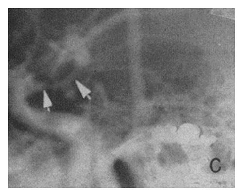Details are in the caption following the image