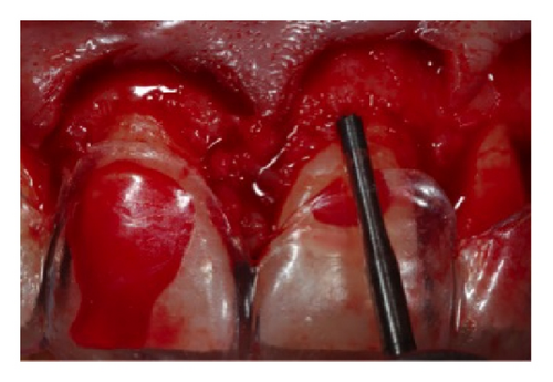 Details are in the caption following the image Details are in the caption following the image