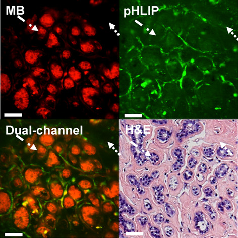 Feasibility of dual-contrast fluorescence imaging of pathological breast tissues