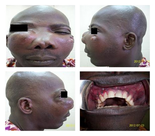 Details are in the caption following the image Details are in the caption following the image