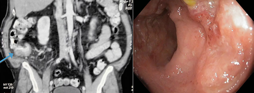 Details are in the caption following the image Details are in the caption following the image