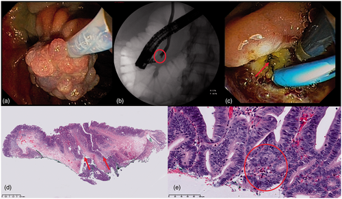 Details are in the caption following the image Details are in the caption following the image
