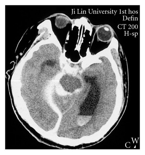Details are in the caption following the image