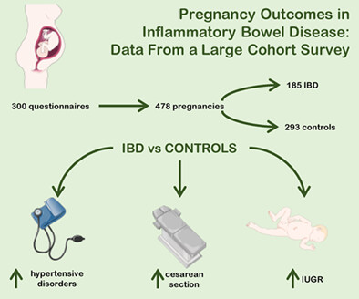 Pregnancy outcomes in inflammatory bowel disease: Data from a large cohort survey