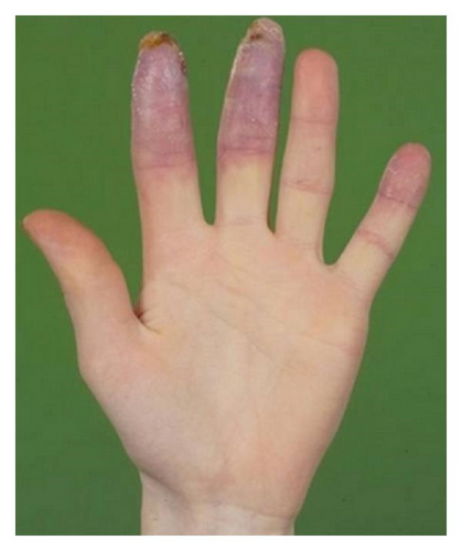 Details are in the caption following the image