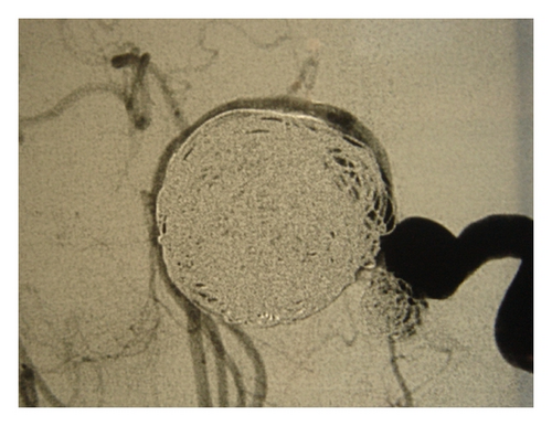 Details are in the caption following the image