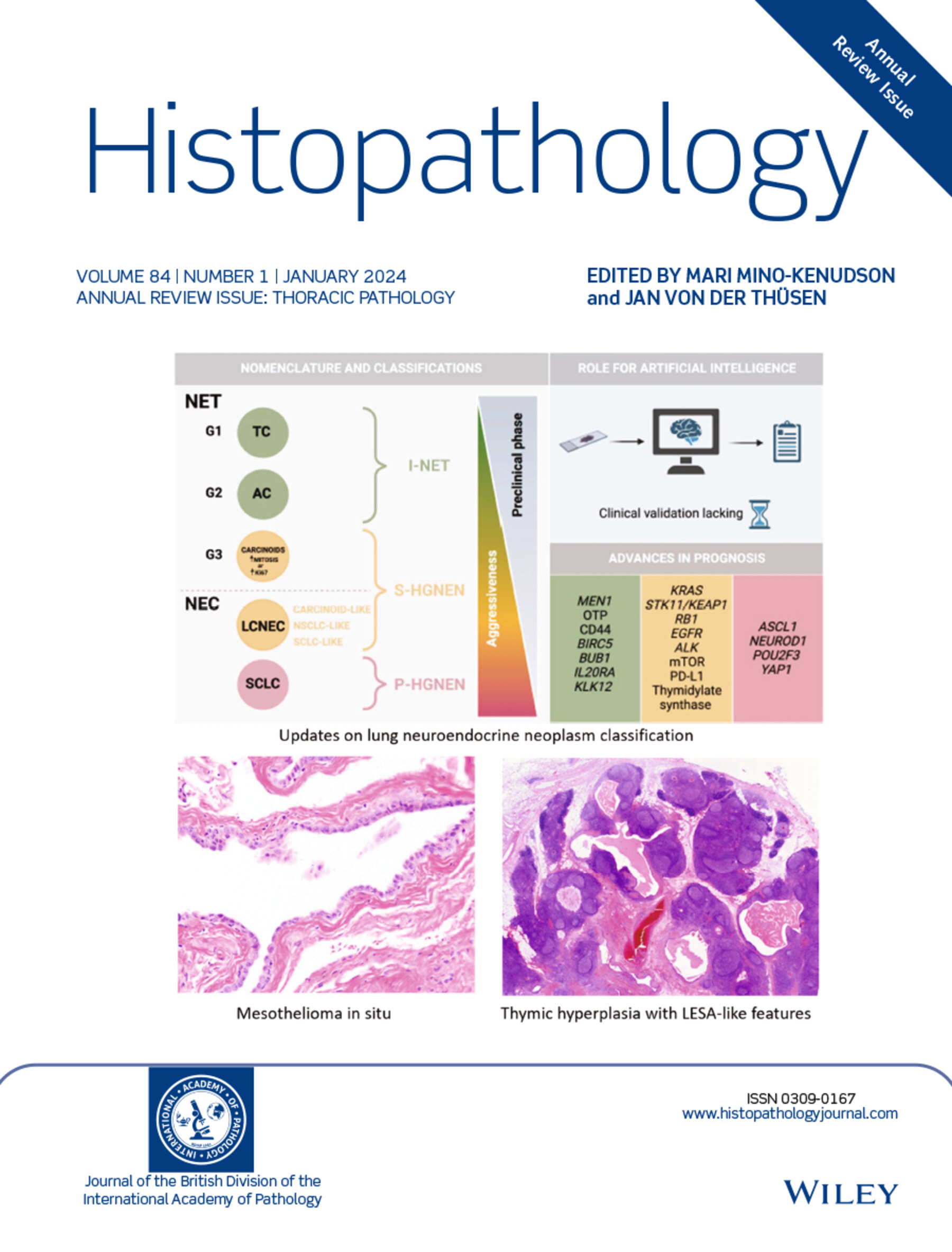 Cover Image Volume 84 Issue 1, 2024