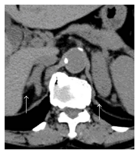 Details are in the caption following the image