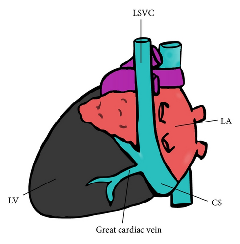 Details are in the caption following the image