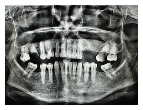 Details are in the caption following the image Details are in the caption following the image