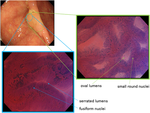 Details are in the caption following the image Details are in the caption following the image