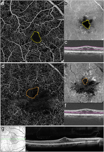Details are in the caption following the image Details are in the caption following the image