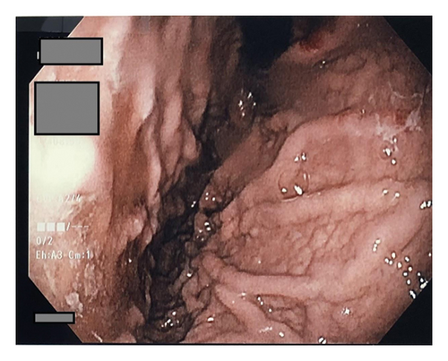 Details are in the caption following the image Details are in the caption following the image