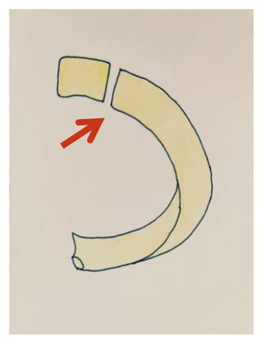 Details are in the caption following the image