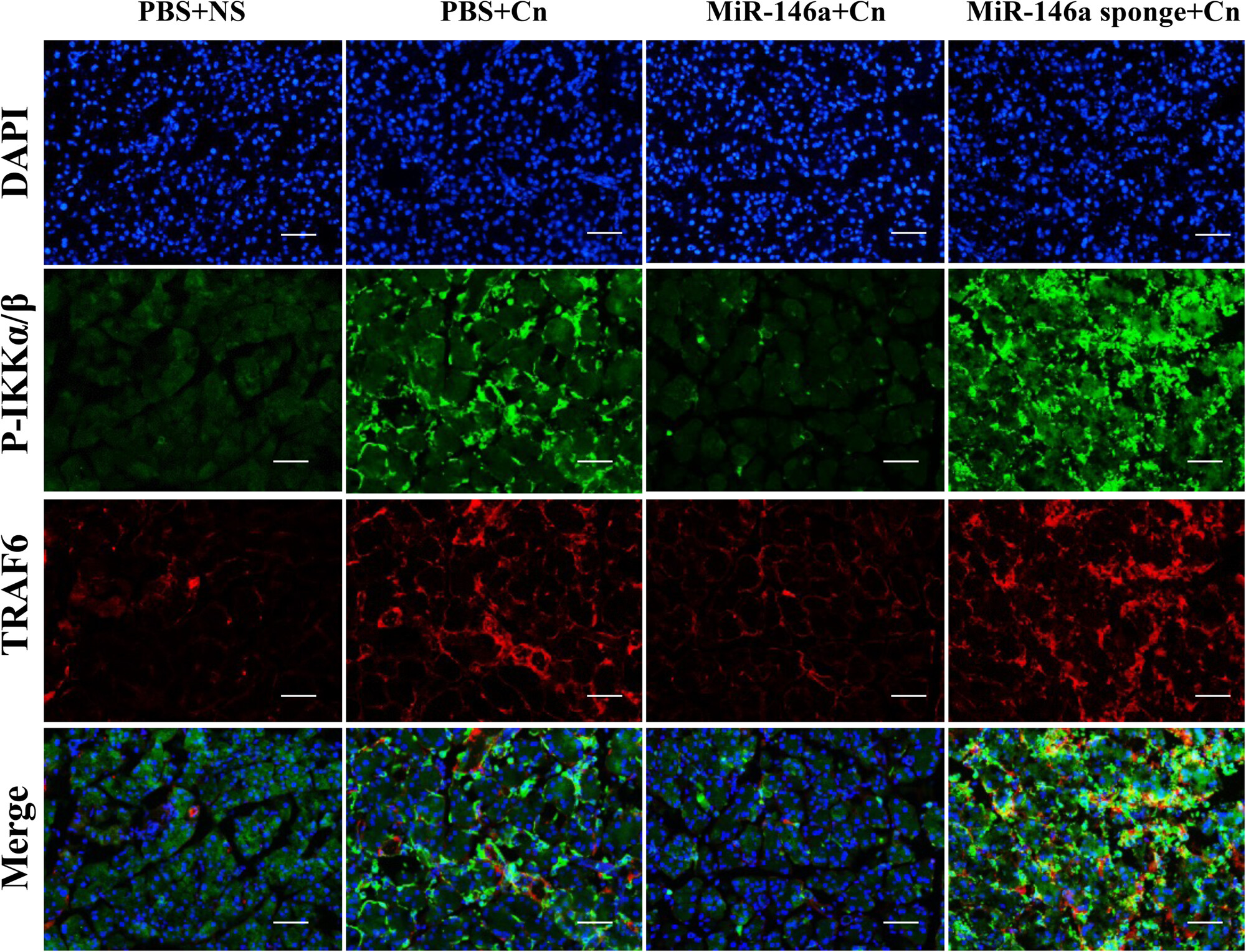 MiR-146a Reduces Inflammation in Experimental Pancreatitis via the TRAF6–NF-κB Signaling Pathway in Mice