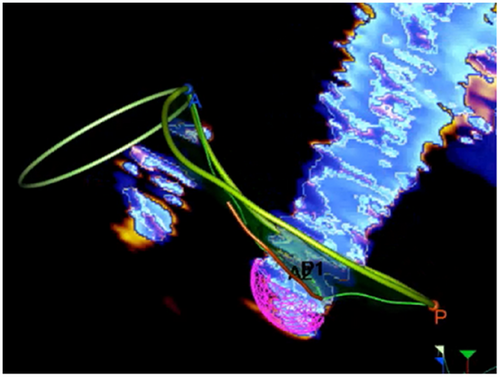 Details are in the caption following the image Details are in the caption following the image