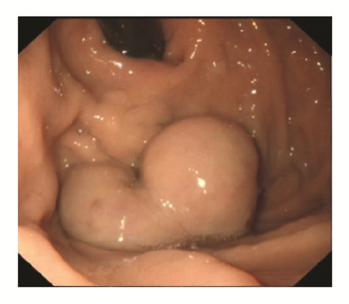 Details are in the caption following the image Details are in the caption following the image