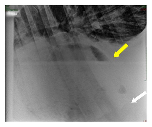 Details are in the caption following the image Details are in the caption following the image