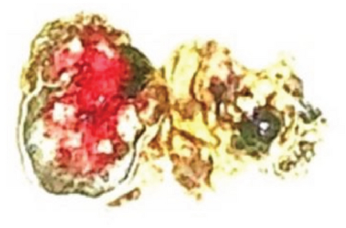 Details are in the caption following the image