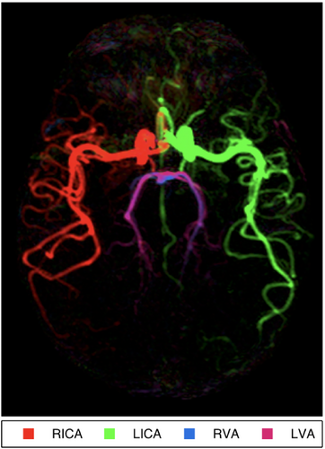 Details are in the caption following the image Details are in the caption following the image