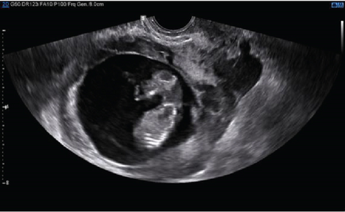 Details are in the caption following the image Details are in the caption following the image